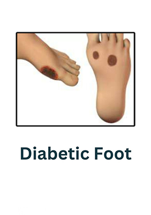 disease 7